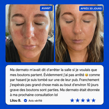 FIZZ - Spray Cutané Quotidien