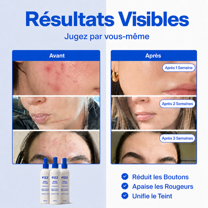 FIZZ - Spray Cutané Quotidien