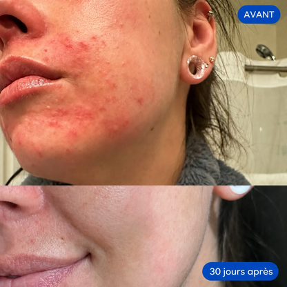FIZZ - Spray Cutané Quotidien
